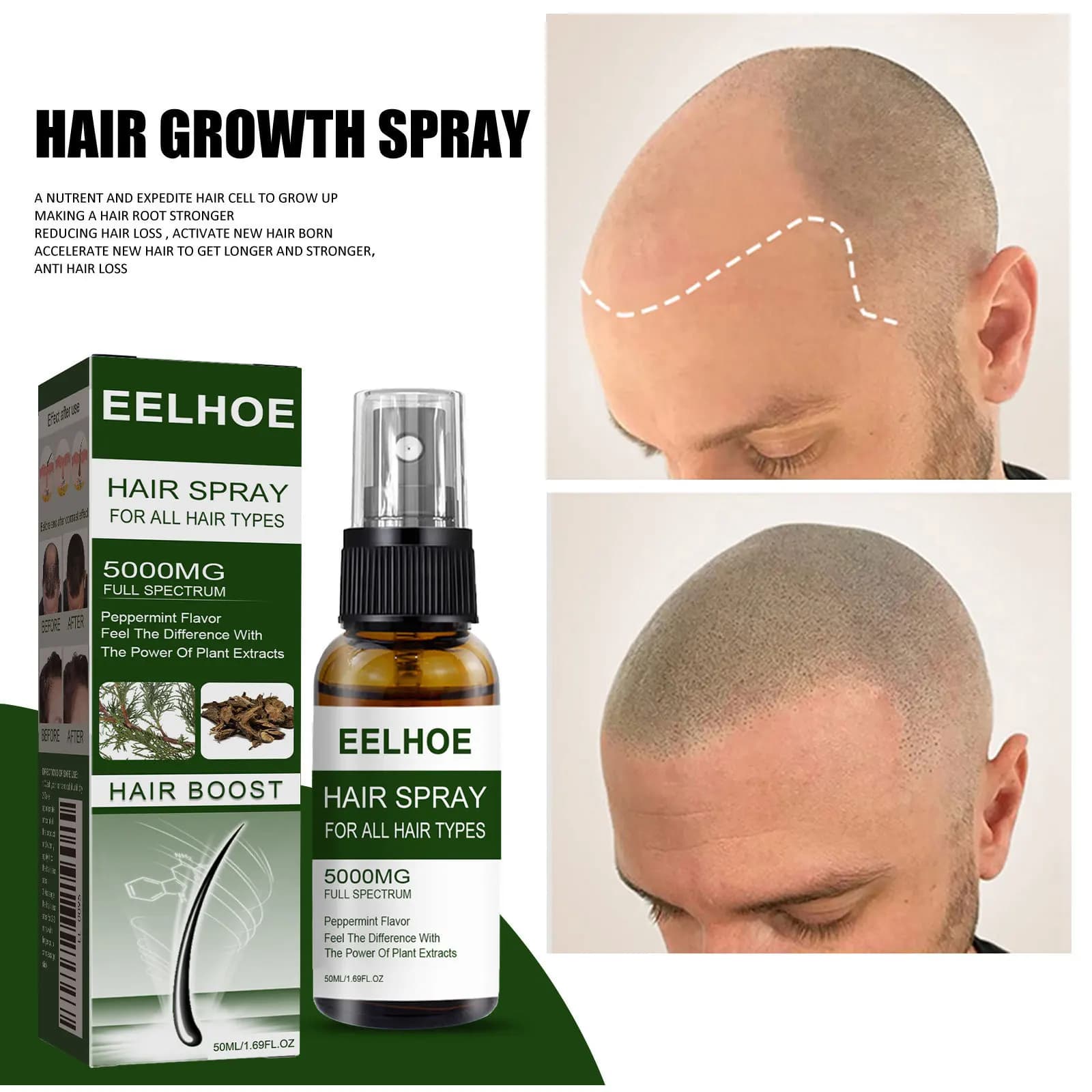 Spray anticaduta per la cura dei capelli Capelli spessi, forti e belli Anticaduta Rassodante per i capelli Idratante per i capelli