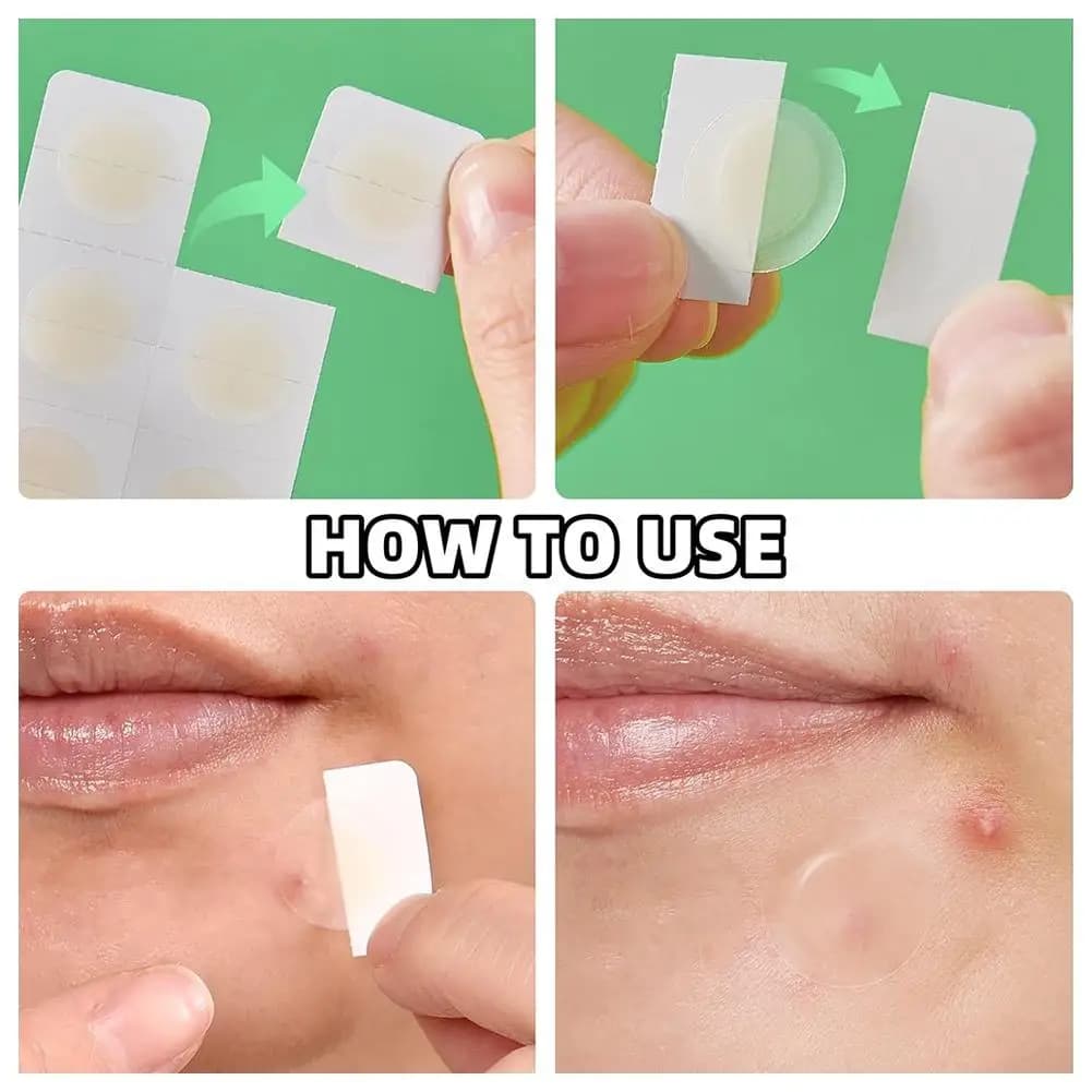 Microaghi Patch per l'acne Rimozione dell'acne Correttore liscio impermeabile Patch traspirante invisibile Patch per la copertura dell'acne Strumento per il trucco delicato