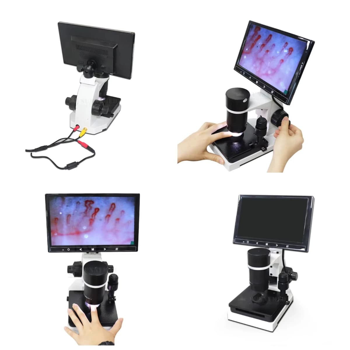 Finger Capillary Microscope SY-B198 Blood Circulation Velocity Observation Device