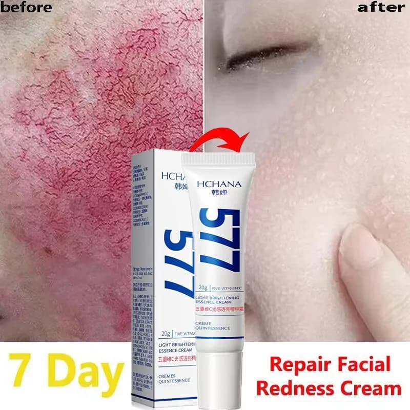Quick Repair Cream for Lenitive Face Redness Treatment Rosemary in Red Blood Improves Cosmetic Hydrating Sensitive Skin for Beauty Care