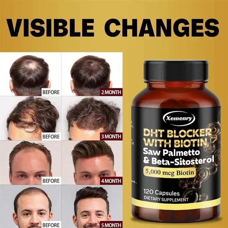 Saw Palmetto for Health of the Prostate Male, Integrator for Promoting Urinary Tract Function - DHT Blocker, Vitamin for Hair - Non GMO