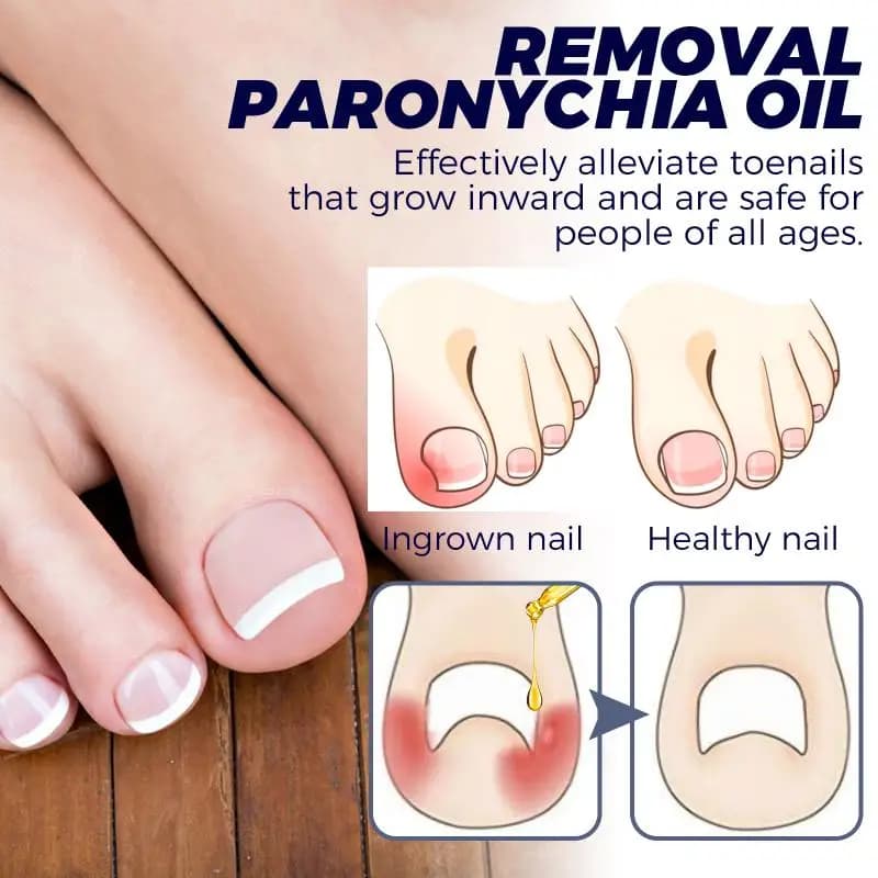 Foot Odor Control Spray Powerful Deodorizer for Shoes and Socks Moisture Resistant Fresh Scent Suitable for Travel