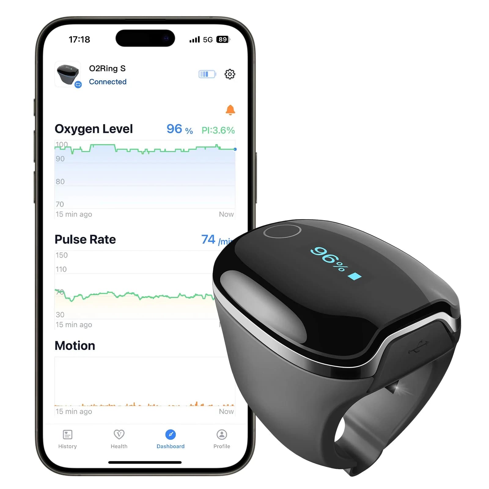 Wellue O2ringS Bluetooth Sleep increasing health Supervisory ring Sensor SpO2 Digital Pulsossimeter