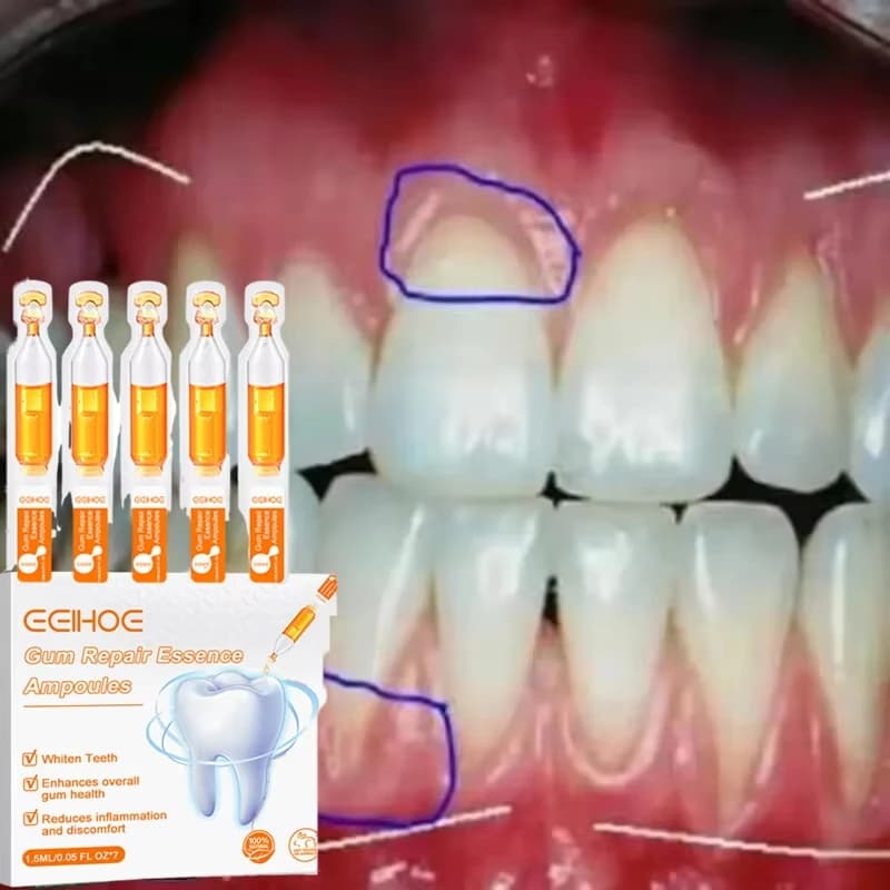 Quick Repair Gel for Gengive, Efficiently Allevia Dentale, Carie, Siero per la Cleaning e il Repair dei Denti