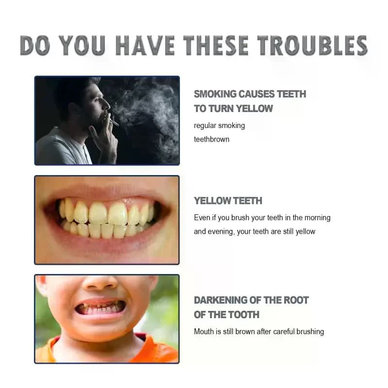 Whitening Pen for Tooths, Removal of Plate and Macchie, Reduction of Tartarus, Anti-Yellow, Fresh Food, Oral Hygiene, Care of Disposable