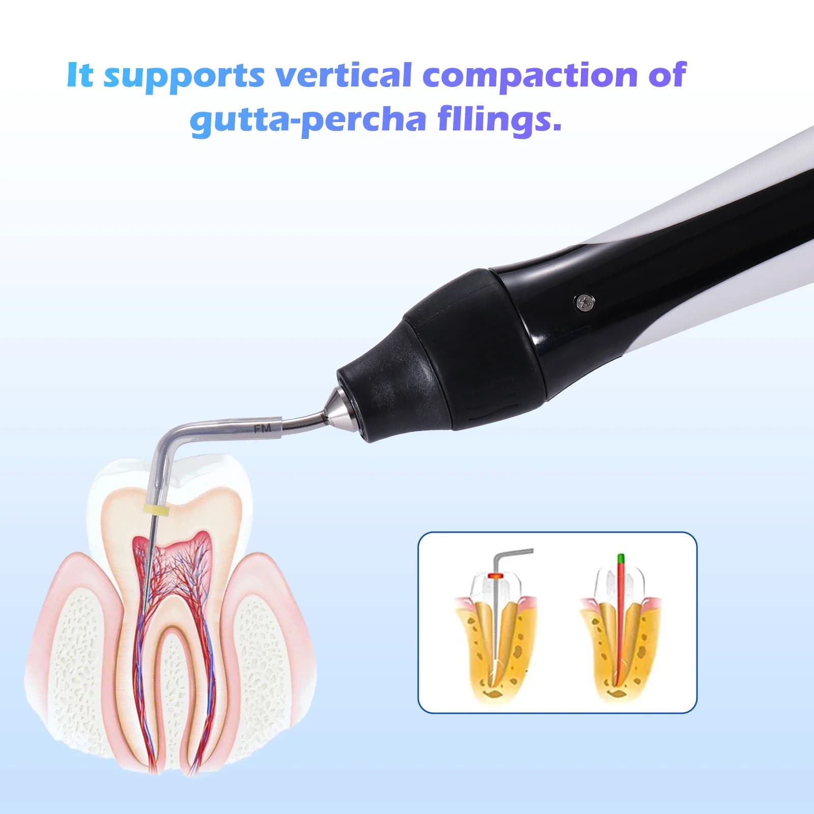 1-5 set Dental Endo Endo Obturazione Sistema Hot Melt Dispositivo di Riempimento Pistola Penna Riscaldamento + Punte Percha Gutta