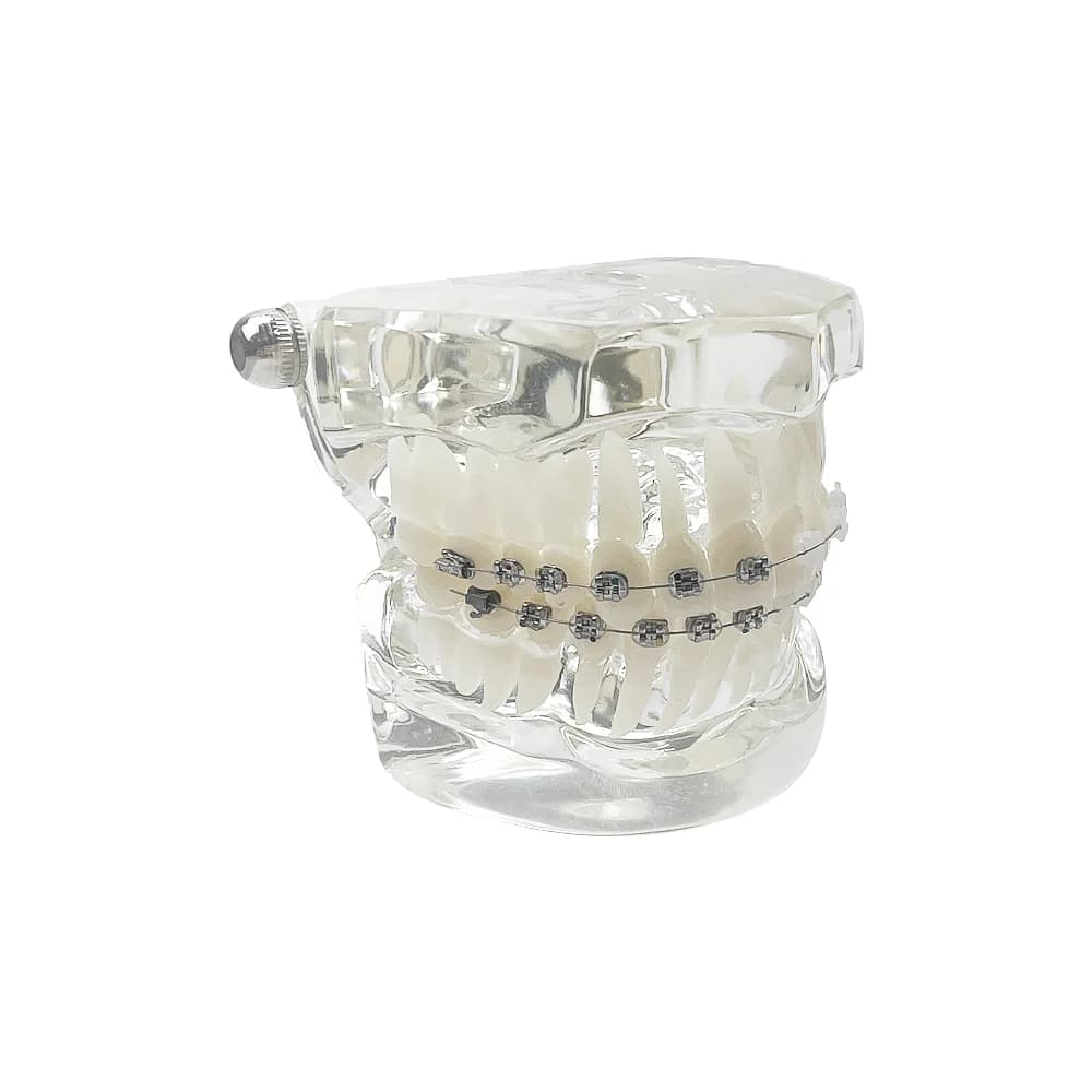 Dentistry Orthodontic Model Typodont Half Metal Half Ceramic Ortho Dental Teeth Model For Studying Teaching Patient Education
