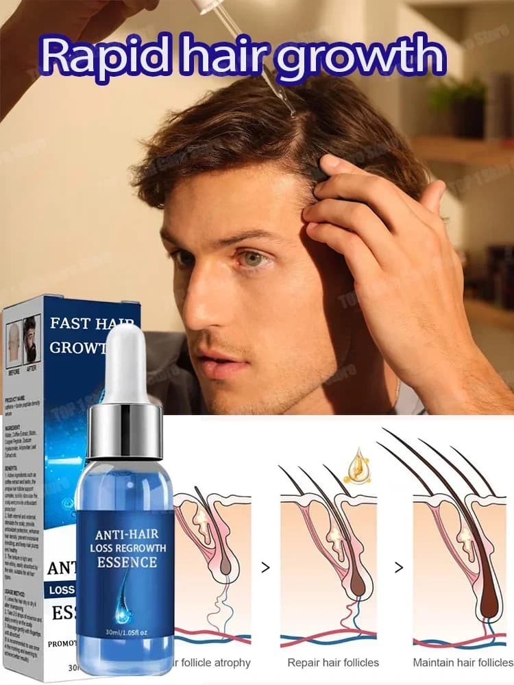 2 Siero per la crescita dei capelli e la caduta dei capelli, prodotti nutrizionali anticaduta per il cuoio capelluto
