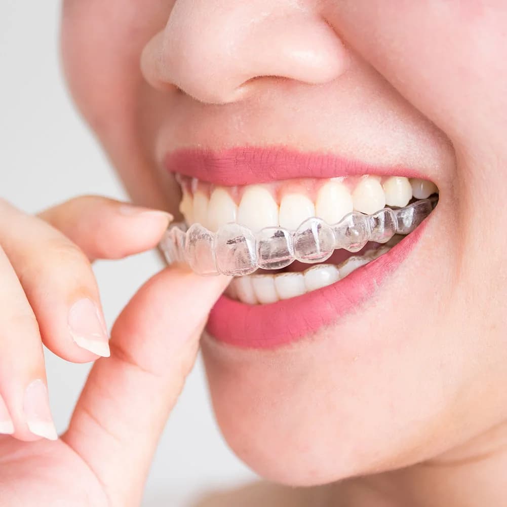2/4pcs Mouth Guard Teeth Protector Guard Mouth Tray for Grinding Anti-snoring Teeth Whitening Protection Orthodontic Braces Set
