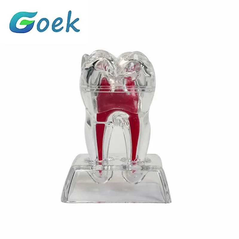 Modello anatomico dentale Trasparente luminoso staccabile Dente singolo Decomposizione Clinica odontoiatrica Ornamenti 4xDenti 70mm
