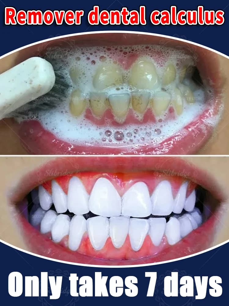 2025 Hot Products Teeth Whitening Mousse Removes Plate and Spots Deep Cleaning Fresh Food Dental Hygiene Tools