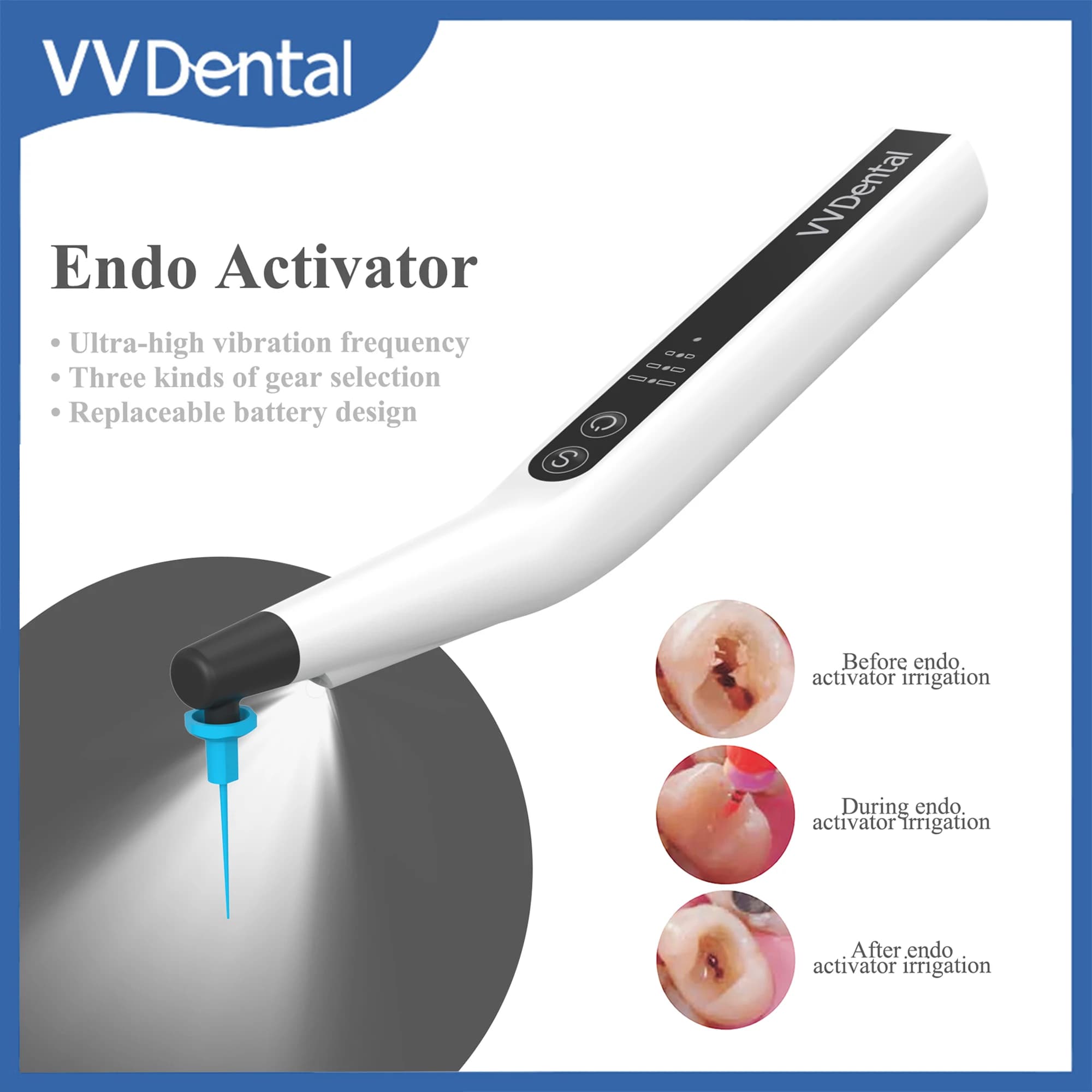 VVDental radicular channel sonic sprinkler with 60 pieces of endo irrigator for dental engine cleaning