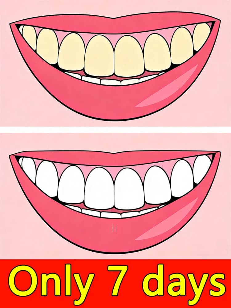 Generazione 2, soluzione per la rimozione del tartaro dentale in 7 giorni per risolvere i problemi delle persone