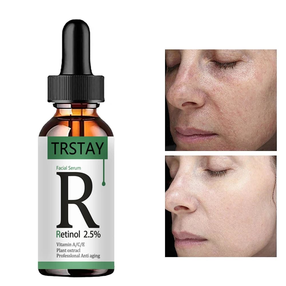 l'essenza viso al retinolo 2,5% vitamina C/A riduce le linee sottili, rassoda la pelle e migliora la pelle danneggiata