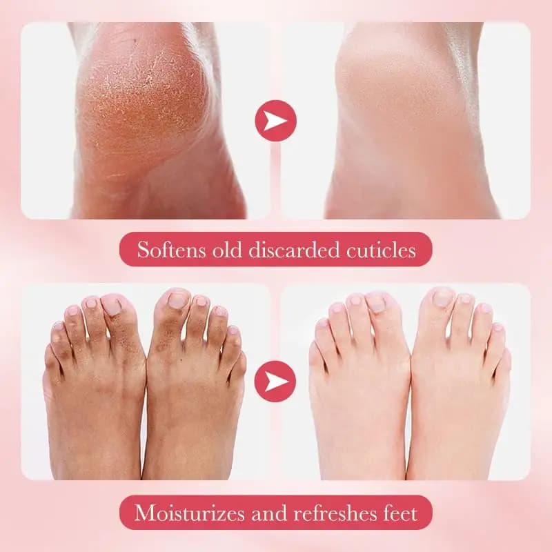 1 SADOER Feet Mask for Fruit, Exfoliating Hydrating Mask, Spa Treatment for Pedicure, Foot Skin Care