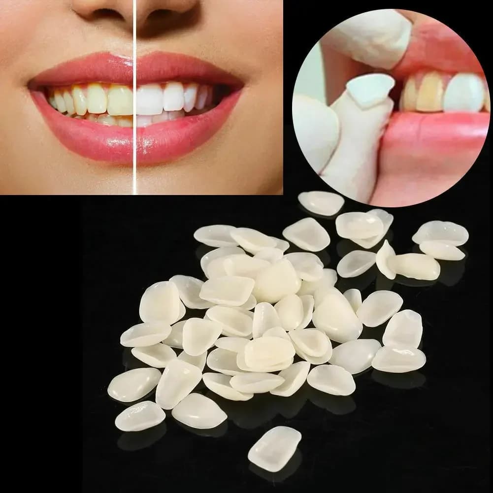 70 pz Falsi Denti Dentali Impiallacciature Ultra Sottile Sbiancamento Resina Anteriore Superiore Corona Temporanea Porcellana Materiale Dentale Igiene Orale