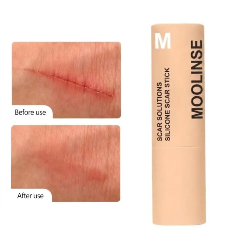 60% Silicone Silicone Scar Stick Velvety Film Centella Asiatica Extracts Scar Treatment Stick Thick Solid Soothing Formula