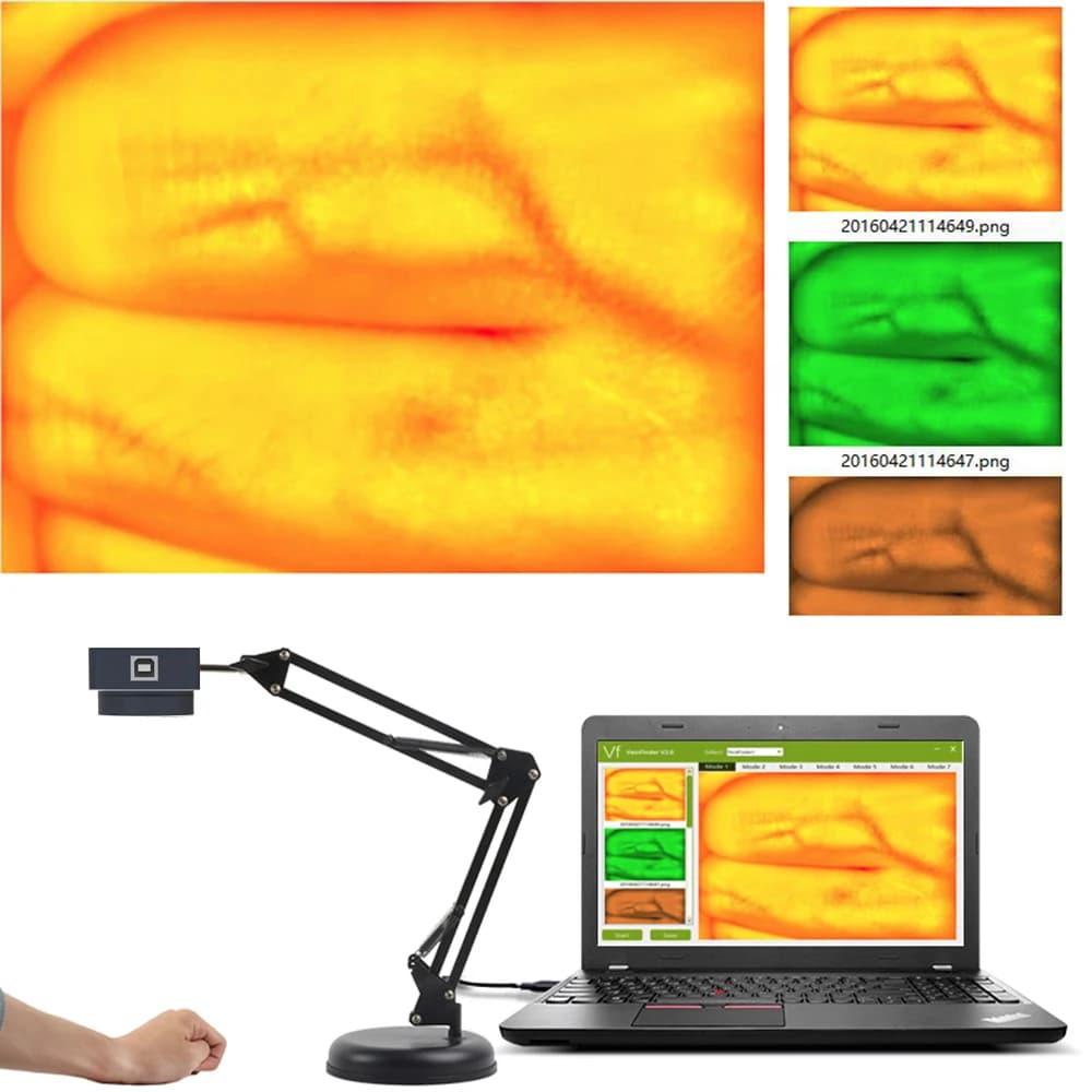 Vein Finder Viewer Display Imaging Vein Finder per bambini adulti mani piedi gambe vene
