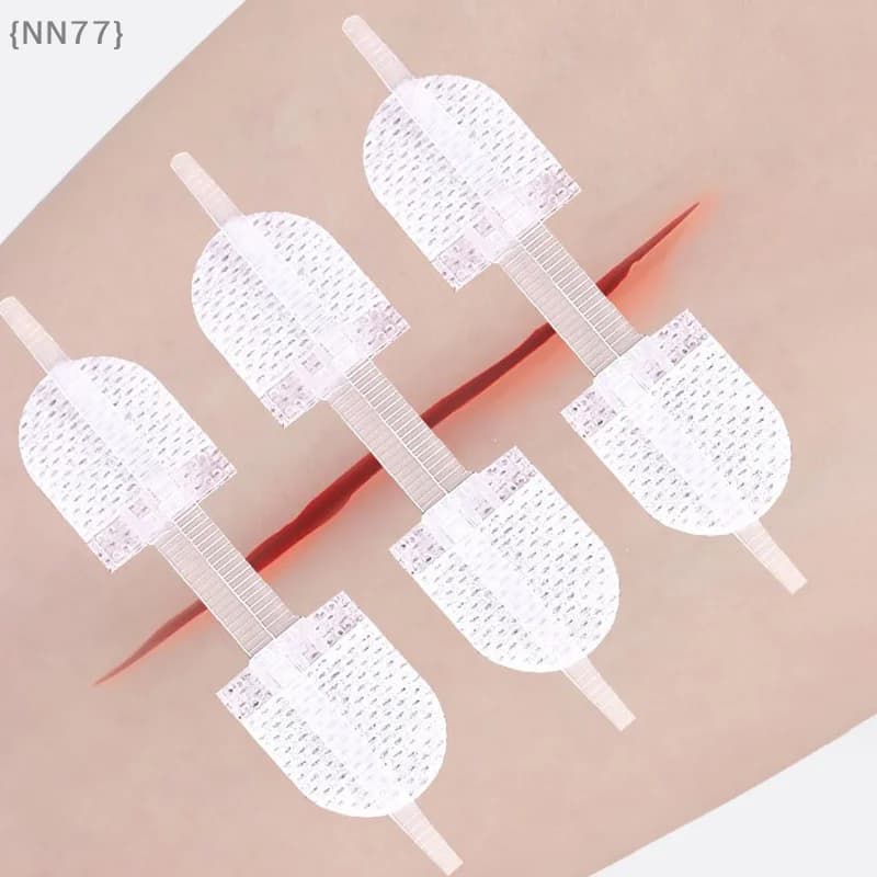 Toppe elastiche per la chiusura delle ferite con cuciture a zip | Bende traspiranti per sutura con cerniera senza cuciture per il supporto della cura delle ferite