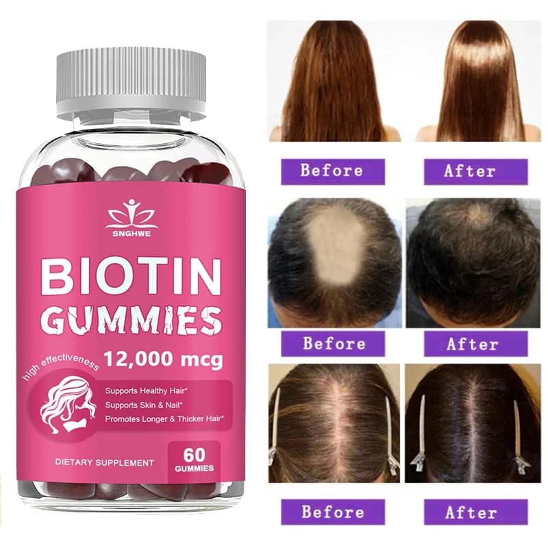 Collagen gumellas Biotin Caramels for Skin Care Health Nails Hair Growth Vitamins Protein Supplement to Collagen