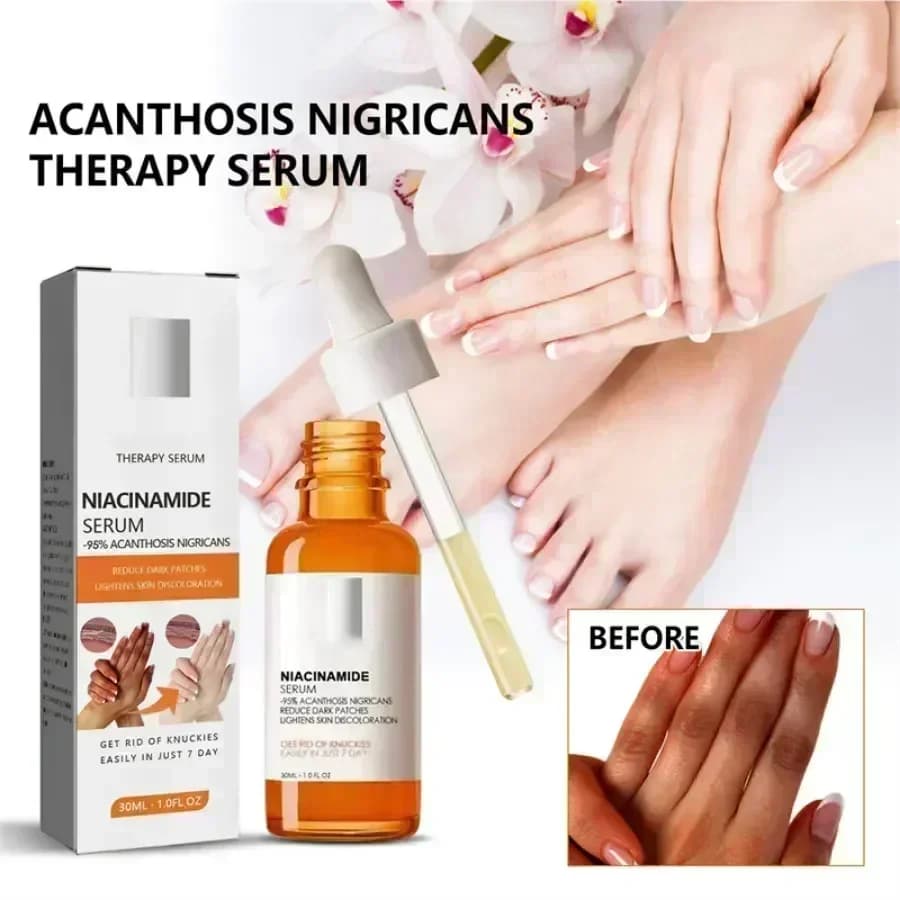 Dark sanders serum whitening elbows armpit Beaching SerumWoman part private skin removal dark knuckles serum whitening strong