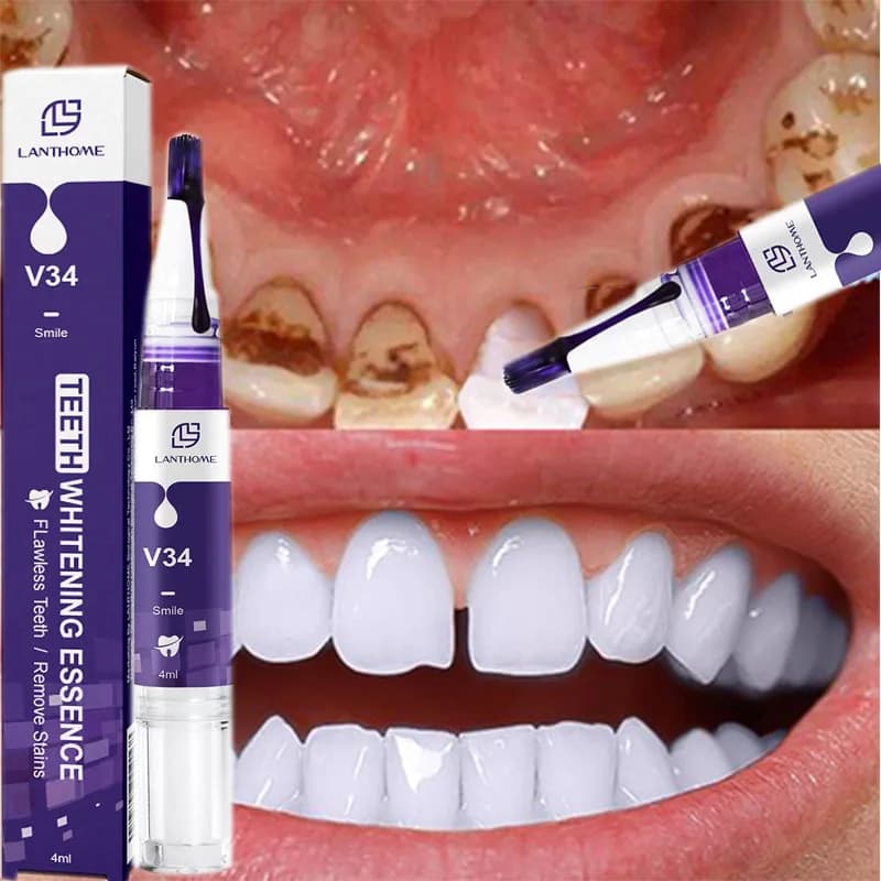 V34 Tooth Whitening Pen Toothpaste Remove Plaque Spots Cleaning Oral Hygiene Whitening Dental Instruments Fresh Food Teeth Care