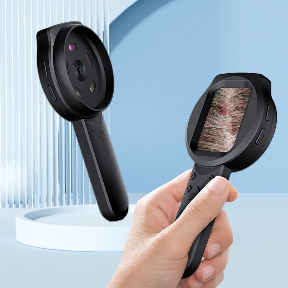 Dermatoscopio Portatile Wireless per Analisi della Pelle, Microscopio Digitale per Cuoio Capelluto/Tricomi e Analisi della Pelle del Viso