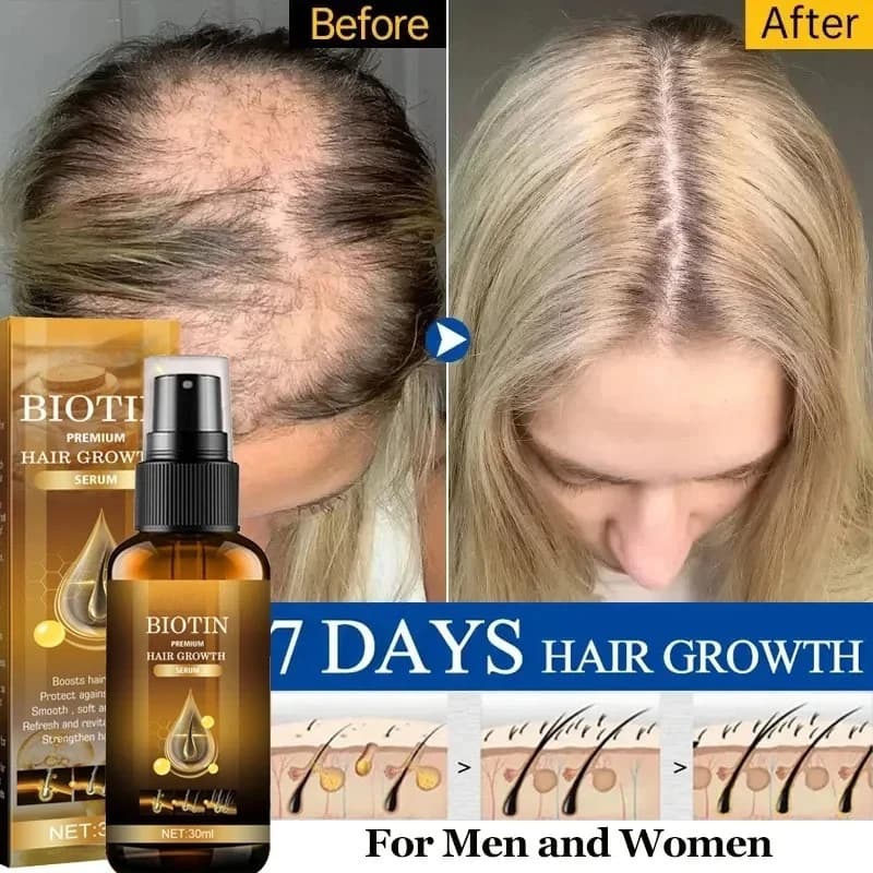 Product for fast hair growth Anti hair loss oil cast iron serum Spray prevent treatment of bald skin scalp beard beauty hair care woman