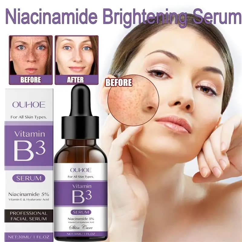 Niacinamide Facial Serum Vitamin B3 Wrinkles Pigment Dark Spot Removal Correcting Glow Serum Face Whitening Moisturizer Serum