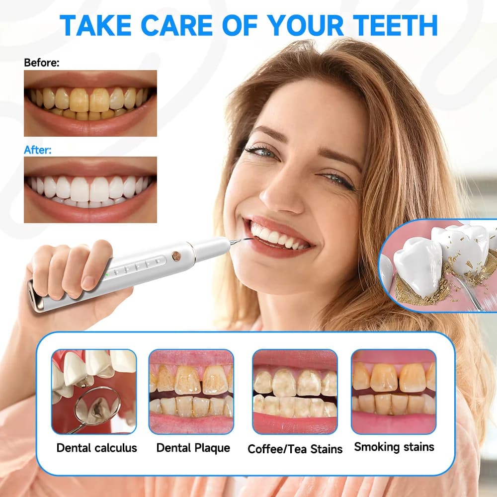 CURVY MOON T4 Portable Ultrasonic Electric Toothbrush Professional Removal of Plate Calculation Tools for cleaning teeth stains removal