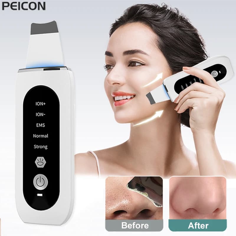 Scrubber per la pelle ad ultrasuoni Peeling rimozione di punti neri pulizia profonda del viso ultrasuoni Ion Ance Pore Cleaner detergente per pala facciale