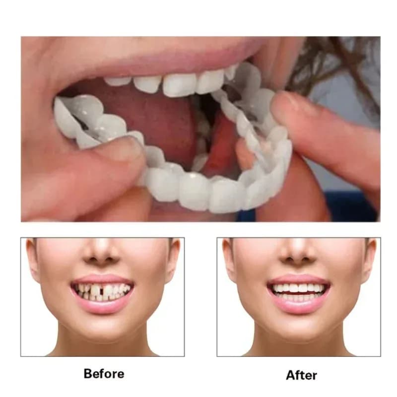 Perfect fit Teeth whitening Faux teeth cover Snap on silicone smile veneers Teeth whitening devices