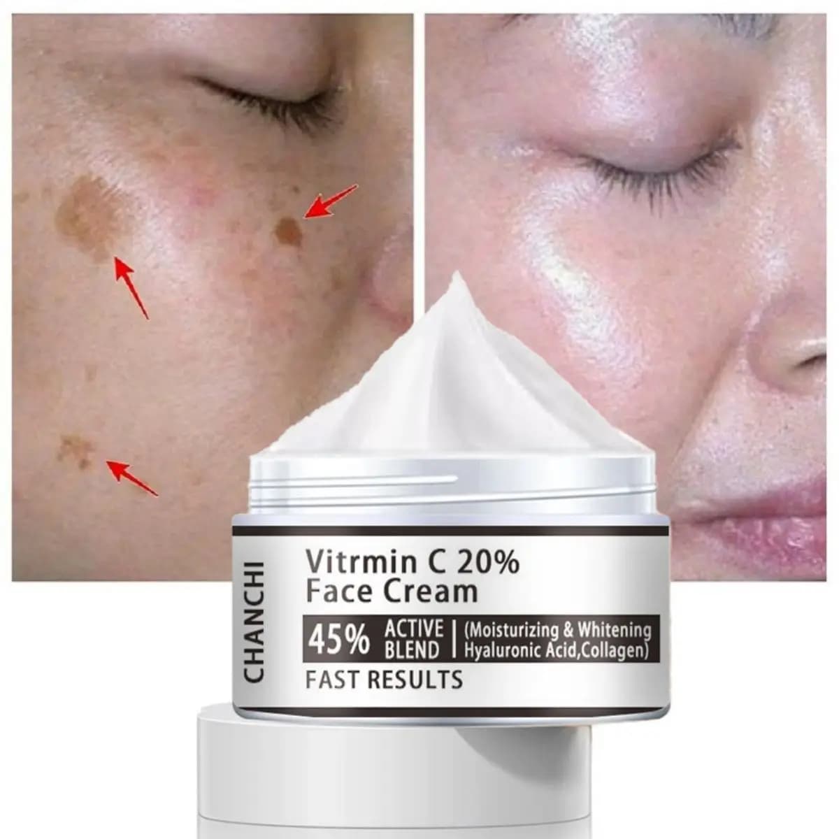 La crema viso alla vitamina C20% può schiarire le macchie, restringe i pori, illumina il tono della pelle e controllare l'olio