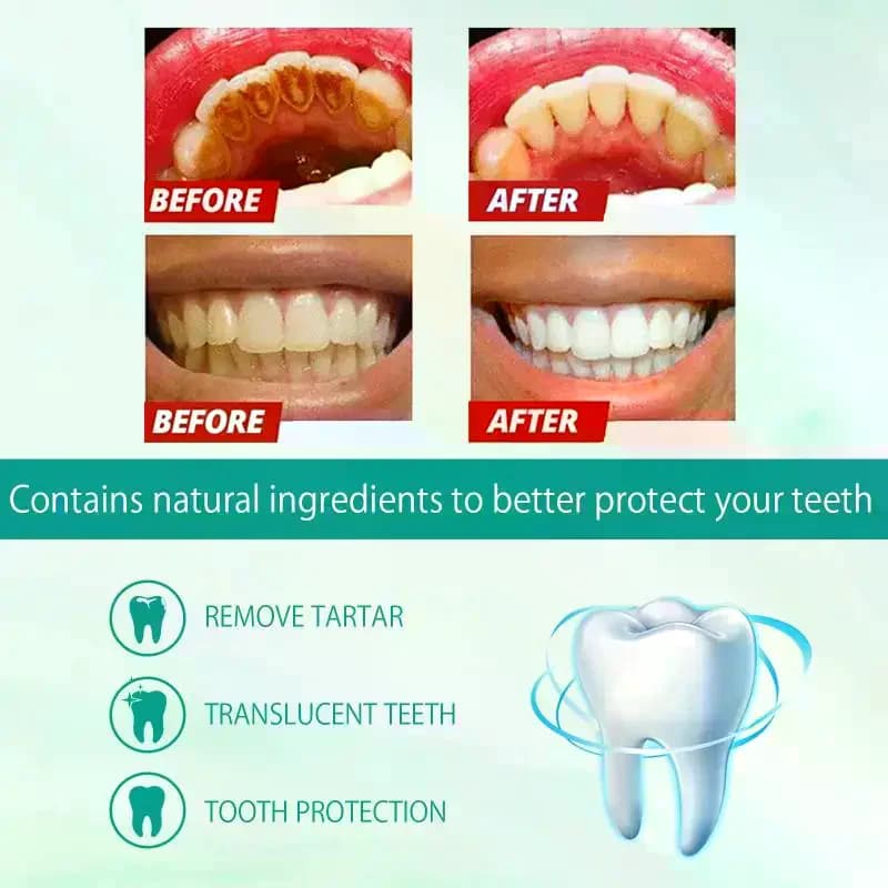 Dentifricio Sbiancante in Schiuma, Pulisce, Previene le Carie, Rimuove la Placca, Protegge le Gengive, Salute Orale, Rinfresca l'Alito, Mousse Riparatrice per Denti