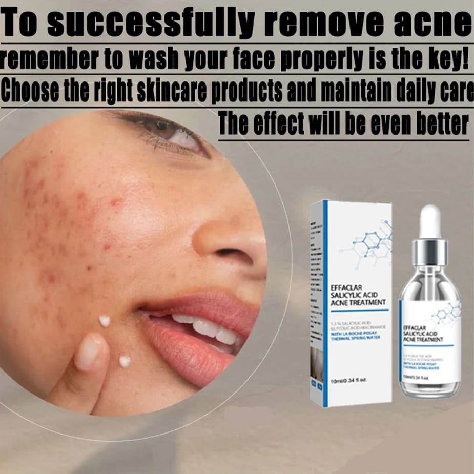Anti acne facial essence, acne removing and smoothing skin, collagen protein, hyaluronic acid essence oil, skin care cosmetics