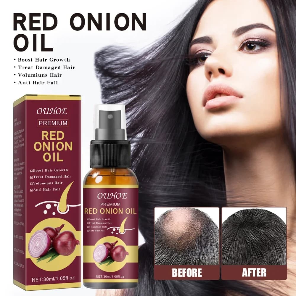 Spray per olio per capelli con semi neri di cipolla da 30 ml per la cura naturale dei capelli e la crescita Previene la caduta dei capelli Biotina Crescita rapida