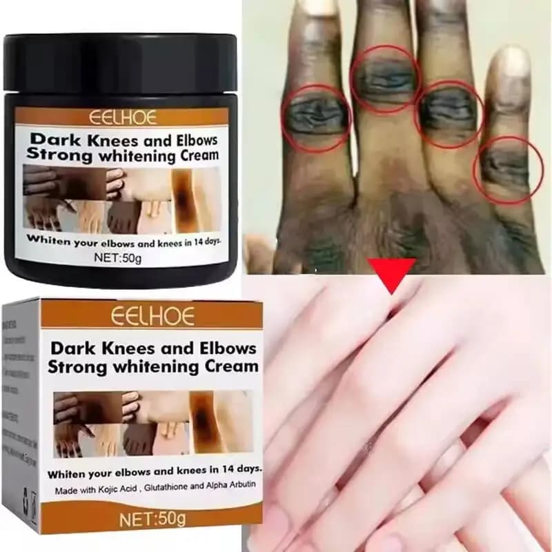 Nocche scure Crema schiarente veloce Gomiti Siero schiarente per nocche a mano Ginocchio Pelle nera Schiarire rapidamente i prodotti per la rimozione delle macchie