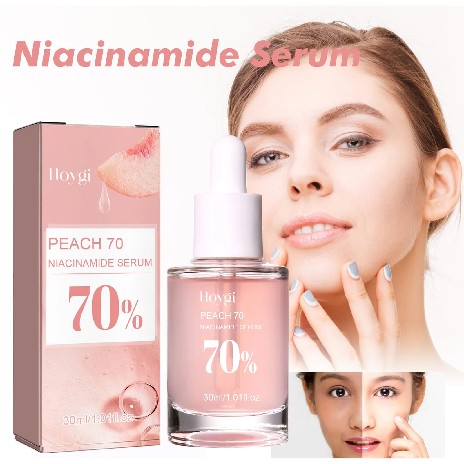Serum of niacinamide Serum Face Pores Minimization Imperfections Clearance Treatment of dark spots Oil control serum for a skin uniform tone 30ml