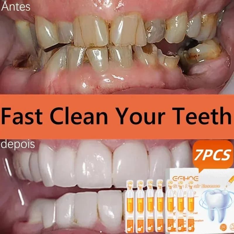 Siero Repair for Gengive, Gocce per Ricrescita Gengive, Whitening for Tooths, Removes Yellow Plate, Macchie, Caries, Toothpaste