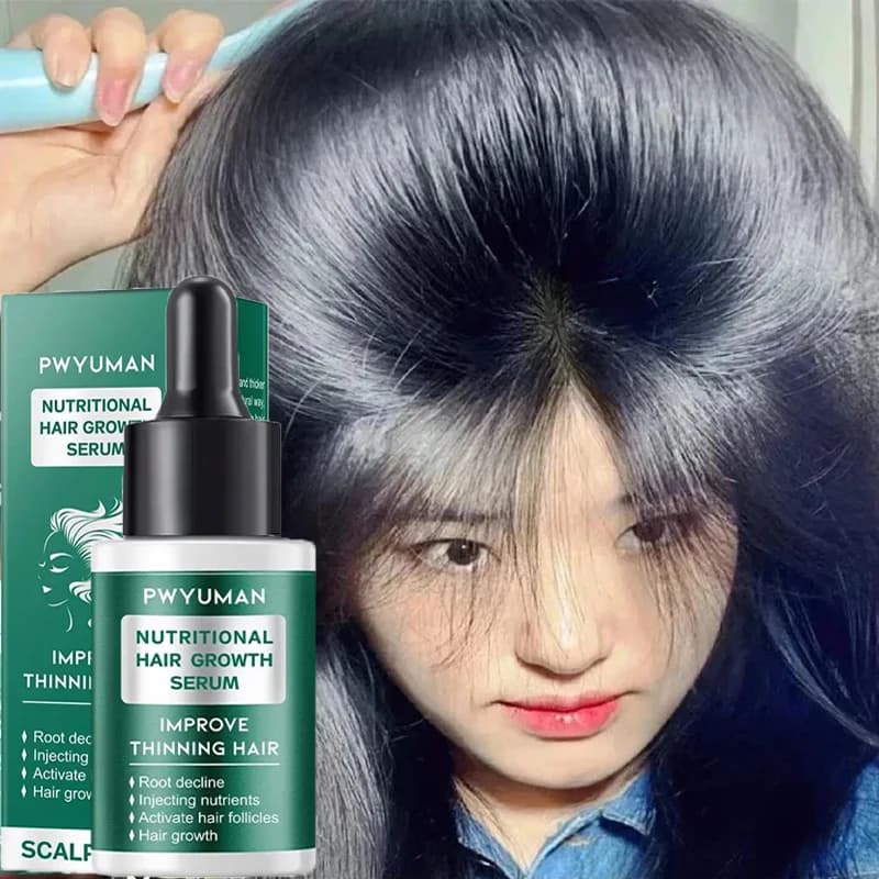 7 days Serum for ginger hair growth Quickly promote hair regrowth products Anti hair loss Repair scalp baldness Feed hair root care