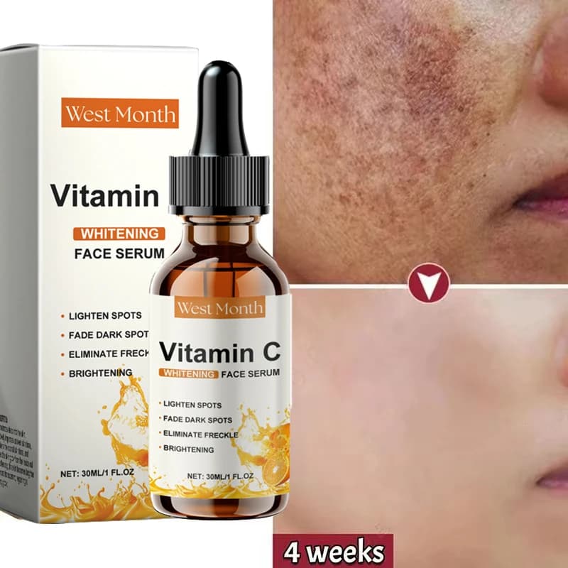 Vitamin C Whitening Serum Face Remove Dark Spots Freckles Fade Melanin Retinol Anti-wrinkle Essence Brightening Korean Skin Care