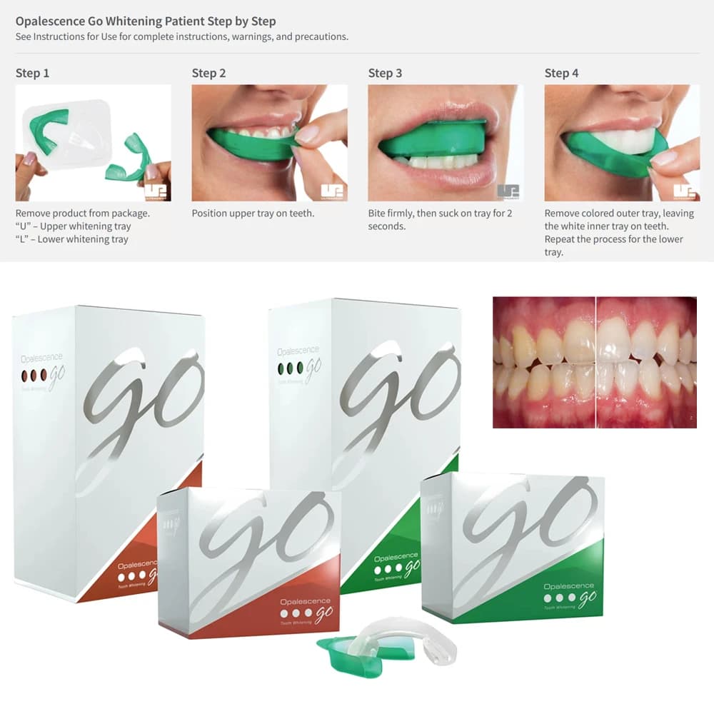 Opalescence Go whitening trays for preriemped teeth At Home Take Patient Kit American Ultradent 15% 15% HP Gel Professional