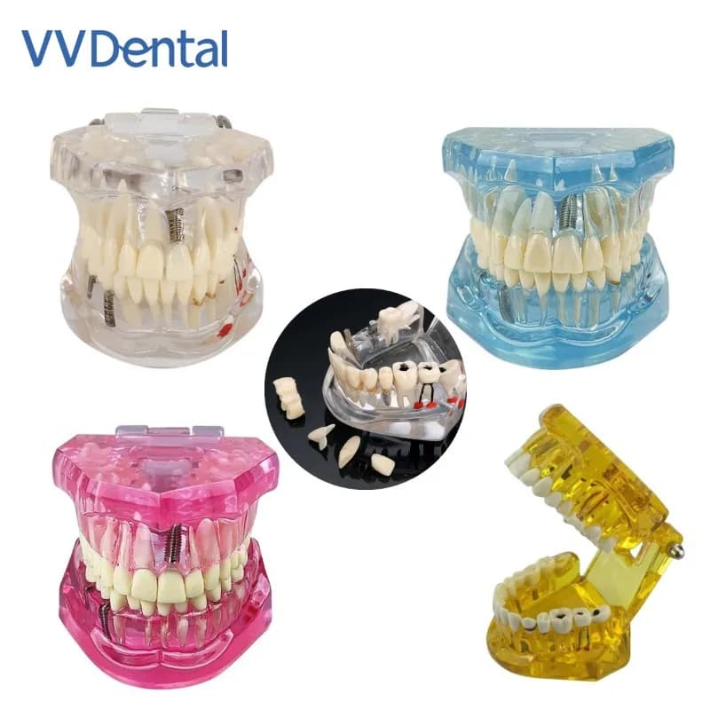 VV Dental 4 Colors Oral Care Teaching Demonstration Model For Studying Dentistry Products Analysis Removable Teeth Model