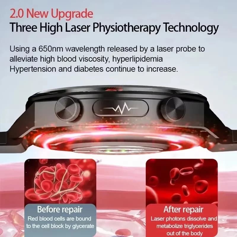 2026 New Supervisory Astute Men ECG PPG Treatment Laser Lipids Blood Pressure Cardiaca Blood Pressure Health Sport SmartWatch For Men Watch ECG
