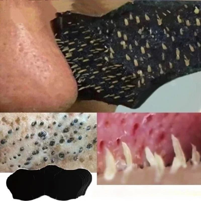 Maschera per la rimozione di punti neri unisex Strisce nasali Ridurre la pulizia dei pori del naso Testa nera Rimuovi adesivi Patch per maschera per la cura della pelle