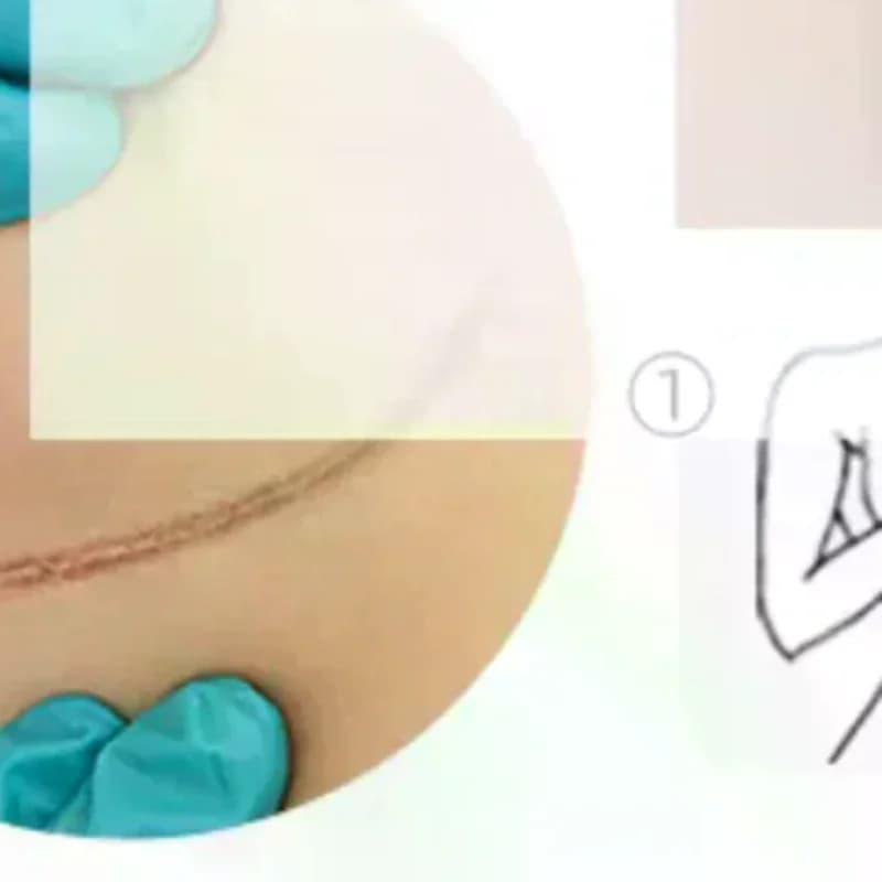 Reusable Silicon Gel Invisible Stickers Circular Arc Chest Invisible Concealer Scar Repair Patch Tattoo Flaw Conceal Tape