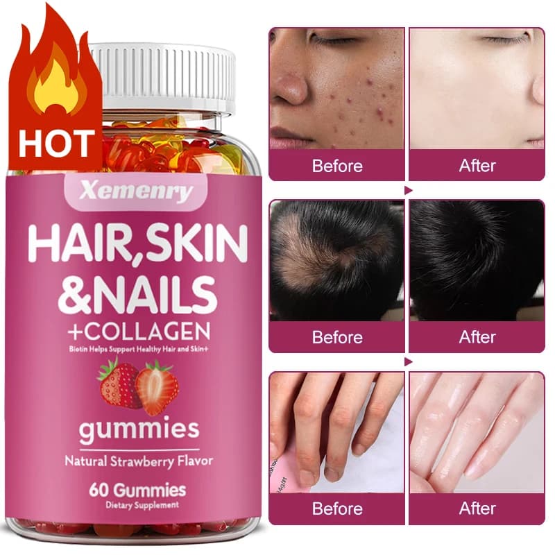 Elbow for hair, skin and nails | Vitamins for hair for men and women | Biotin supplements