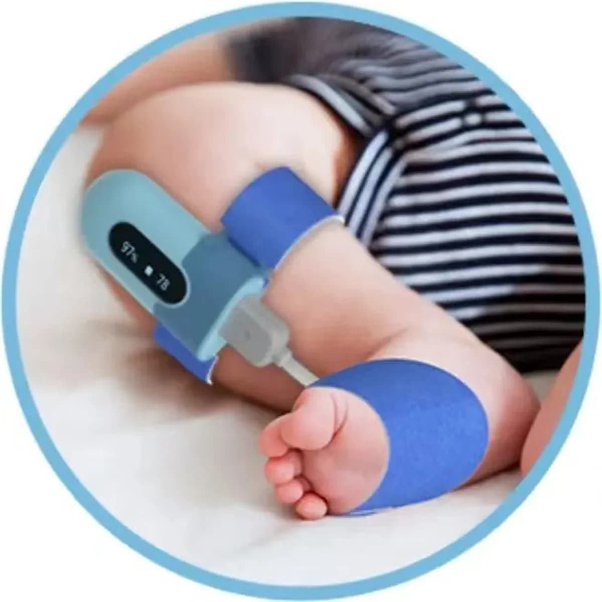 Wellue BabyO2 Smart Sock Neonatal Pulse Oximeter Wireless Bluetooth Baby Pulse Oximeter for Infants And Neonates