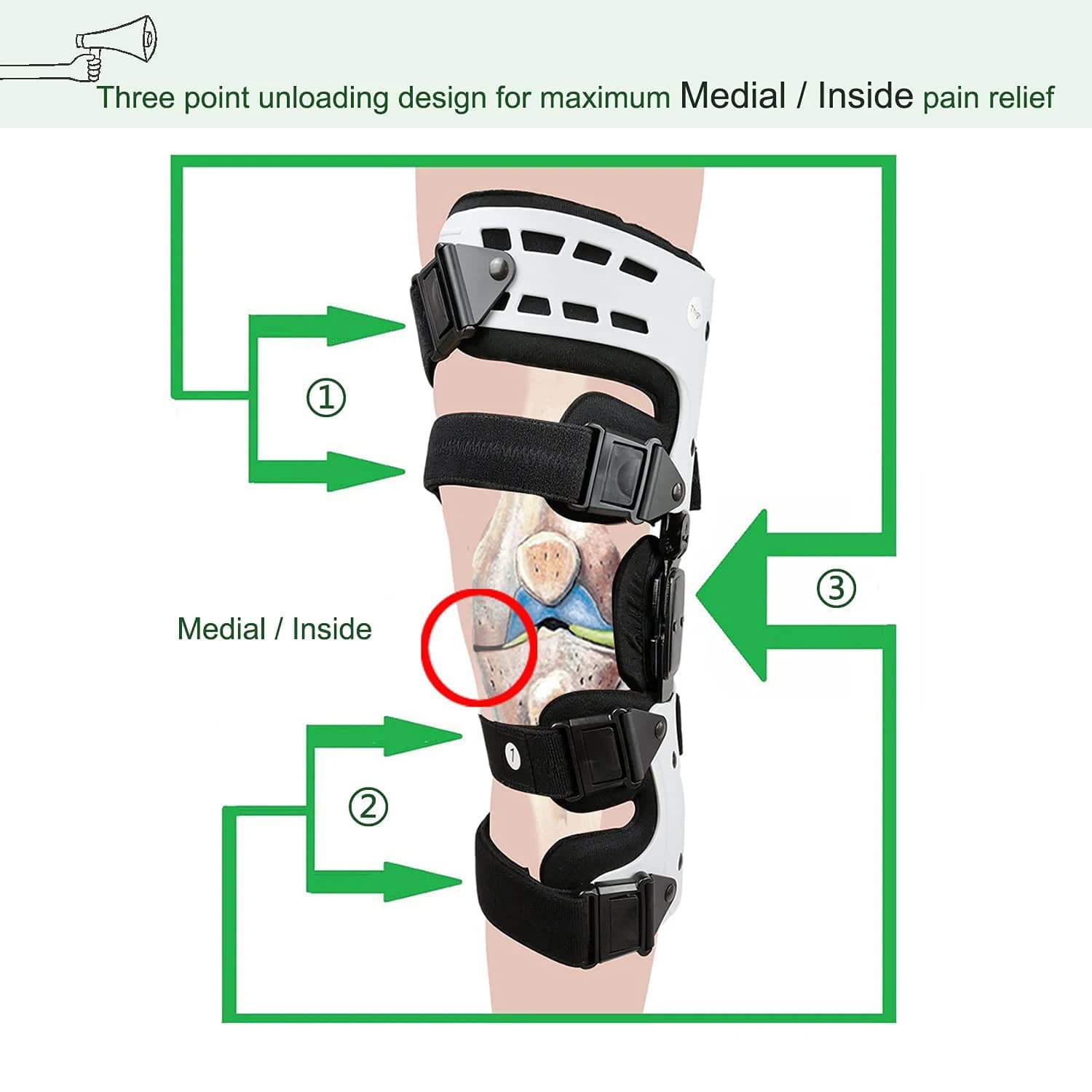 Supporto per Ginocchio Personalizzabile per Dolori Articolari Mediali, Osteoartrite, Protezione Cartilaginea