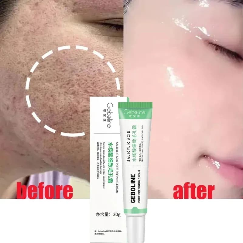 Crema restringente per pori di acido salicilico eliminazione rapida pori grandi rimuovi il Blackehead stringere il viso pelle liscia prodotto per la cura coreana